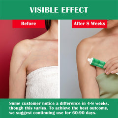 On-skin view of Ladygo Advance Gel on face for scar care