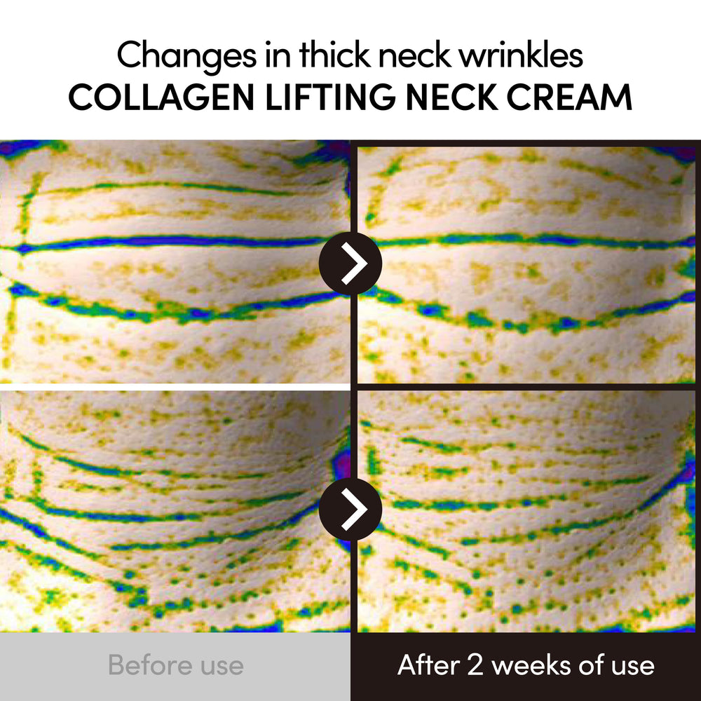 LAGOM jawline neck roller massage tool in use highlights jawline definition.