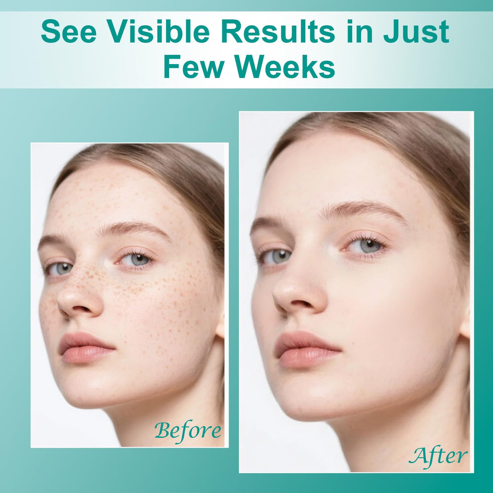 Lakico dark-spot-remover creamy texture shown during application on arms.
