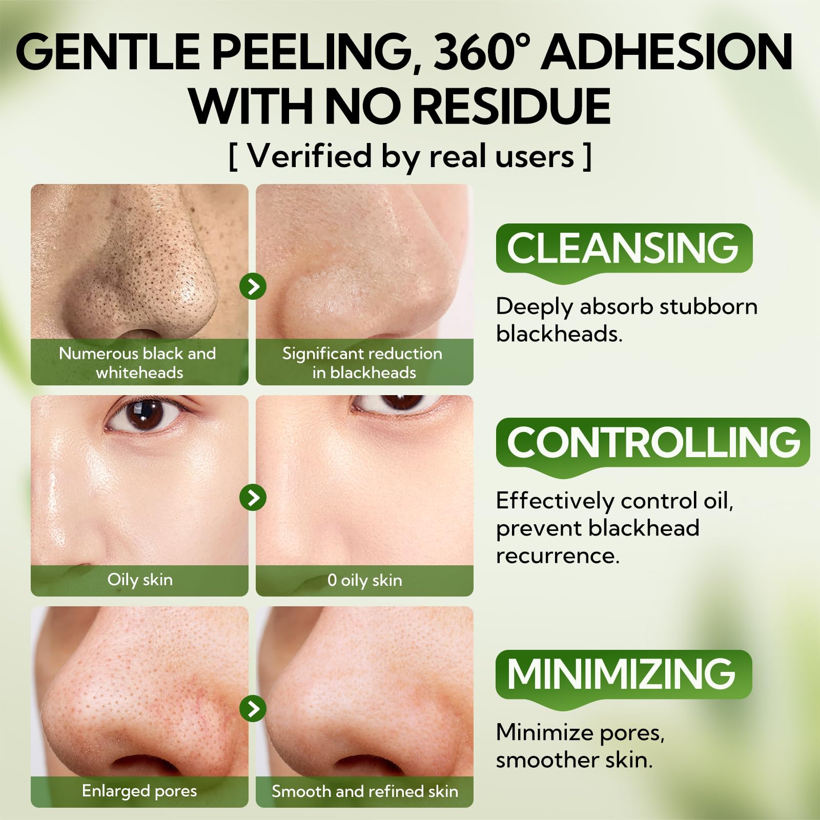 LANBENA 3.0 aloe vera mild formula soothes skin during use