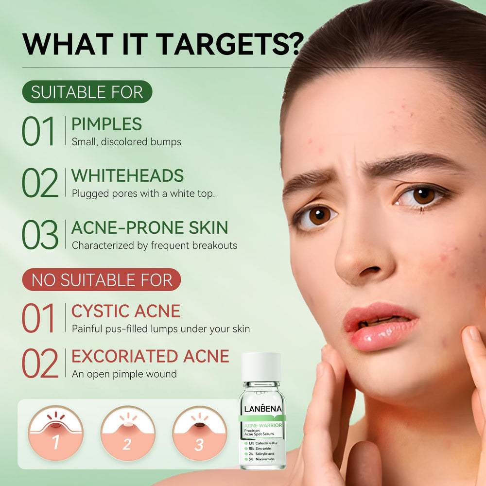 LANBENA acne spot serum texture closeup highlighting lightweight, fast-absorbing formula.