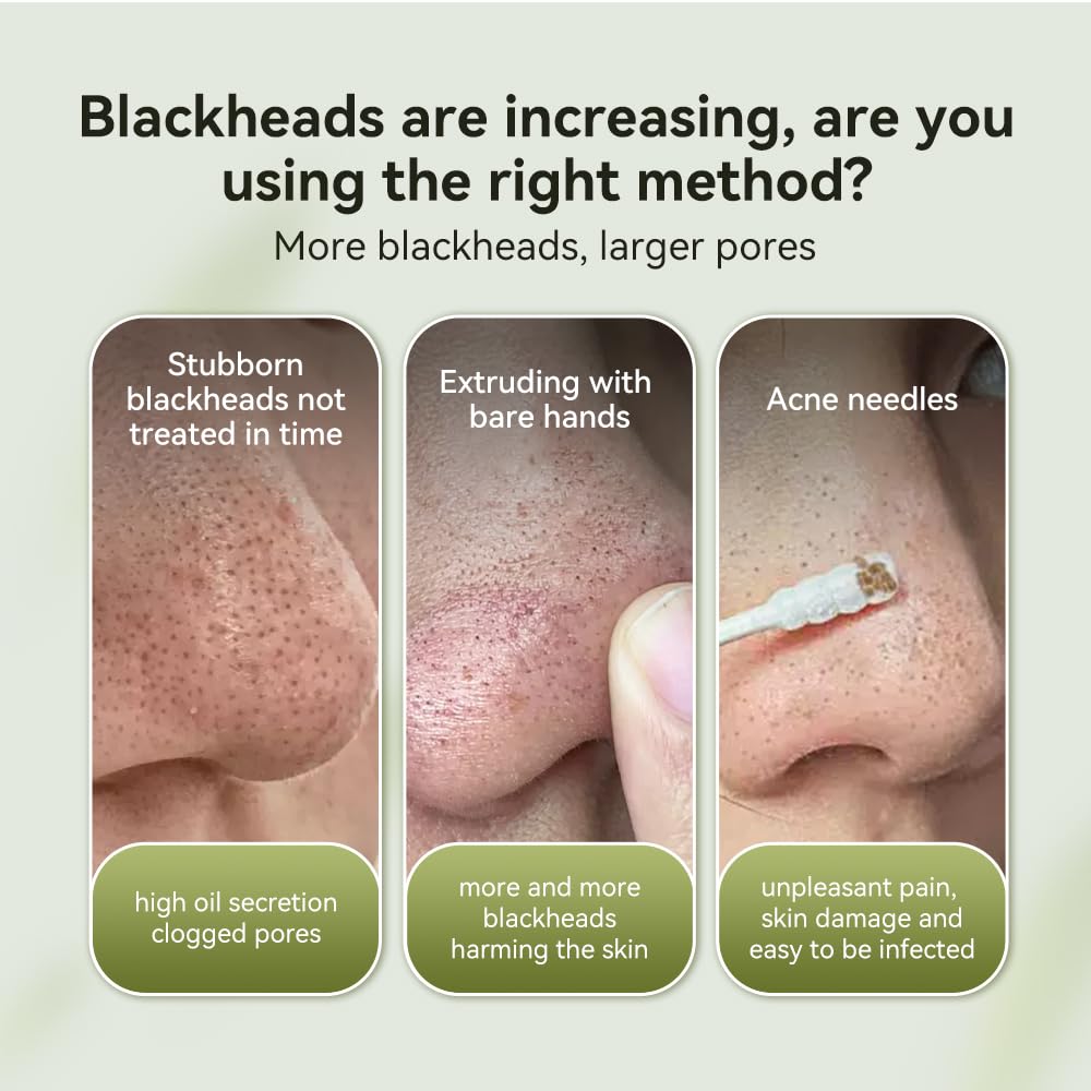 LANBENA nose strips pack open highlighting purifying strips for deep cleanse.