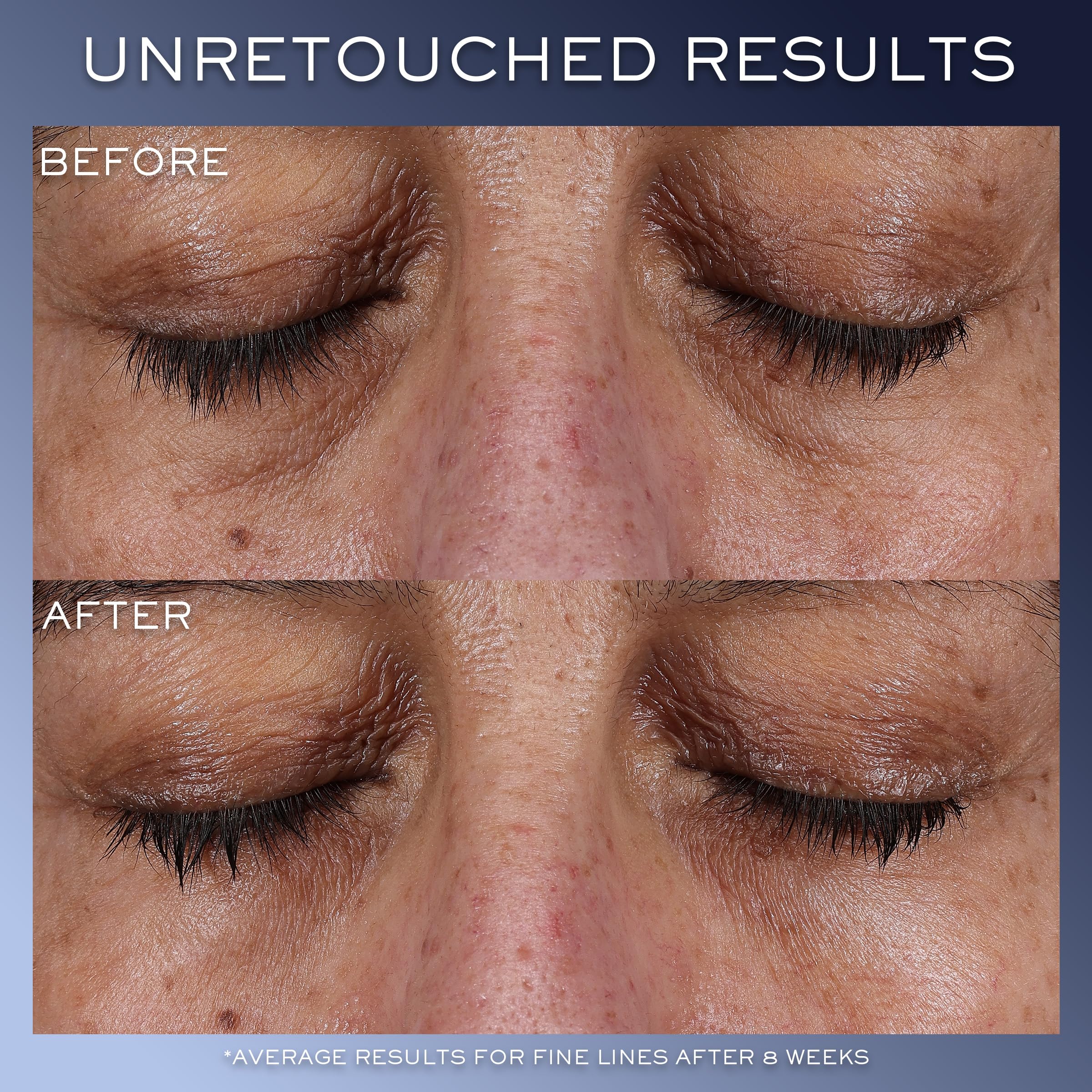 Lancôme Génifique Eye Cream application swatch shows hydrating formula for delicate under-eye skin.
