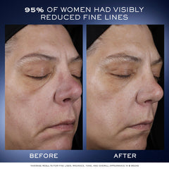 Lancôme Genifique Ultimate Dual Recovery serum application, showing user applying serum on cheek.