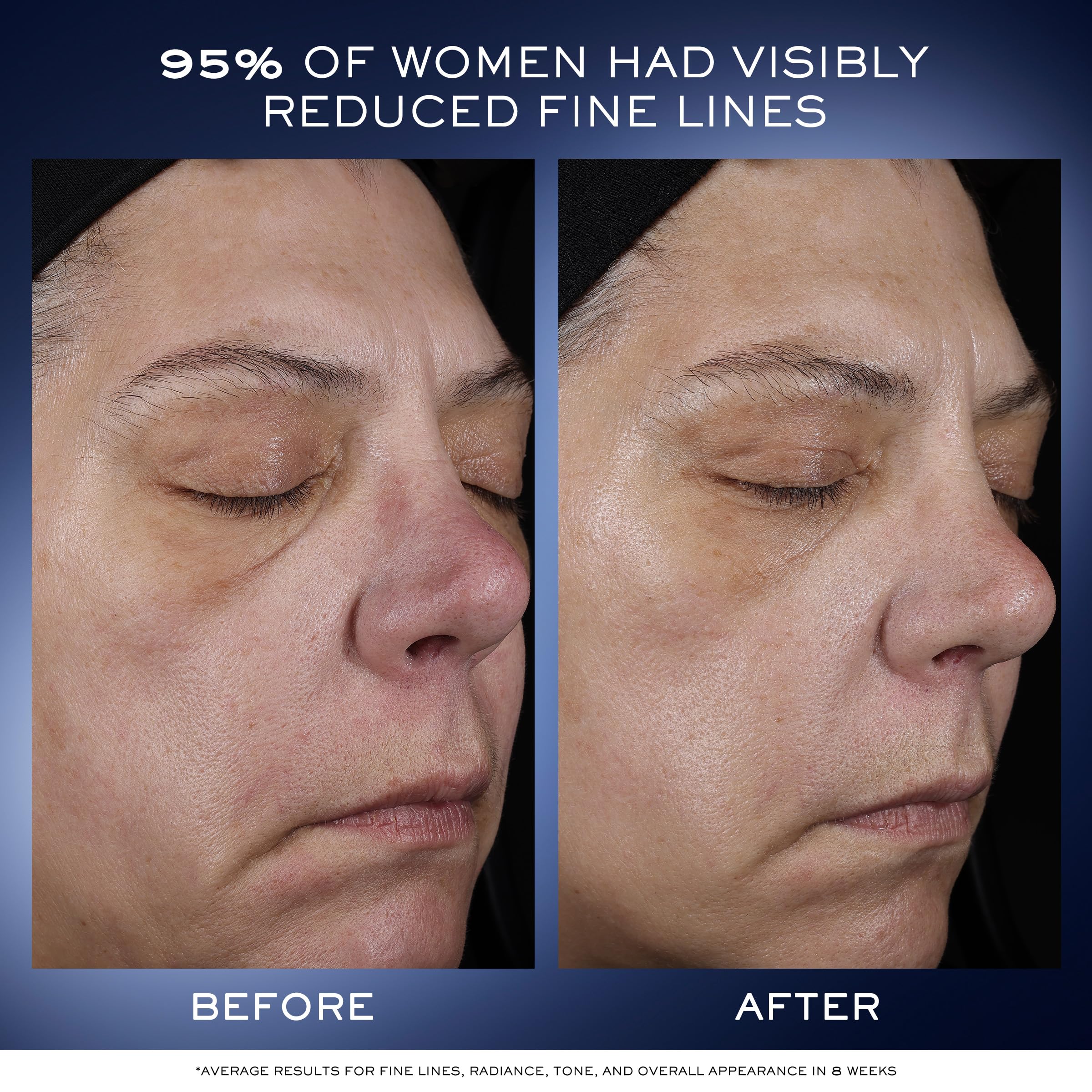 Lancôme Génifique Ultimate Dual Recovery serum beta-glucan illustration signals barrier-support benefits.