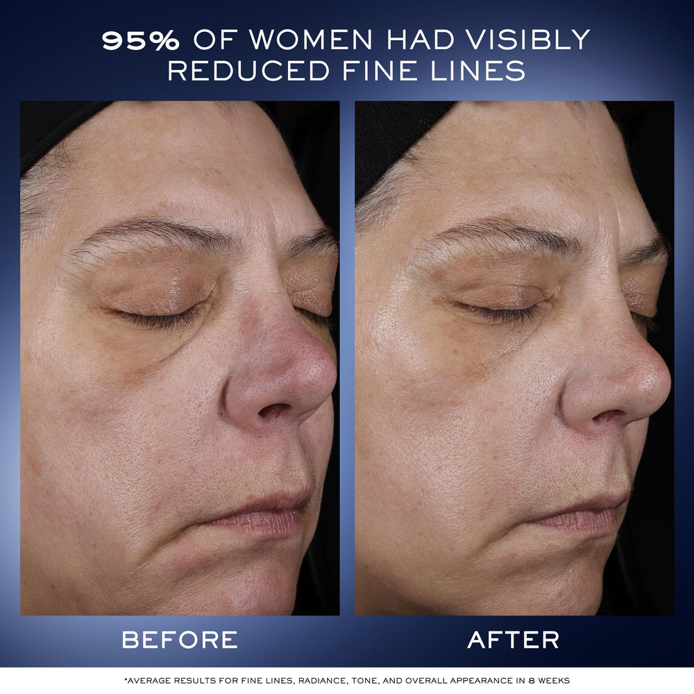 Lancôme Génifique Ultimate Dual Recovery serum beta-glucan illustration signals barrier-support benefits.