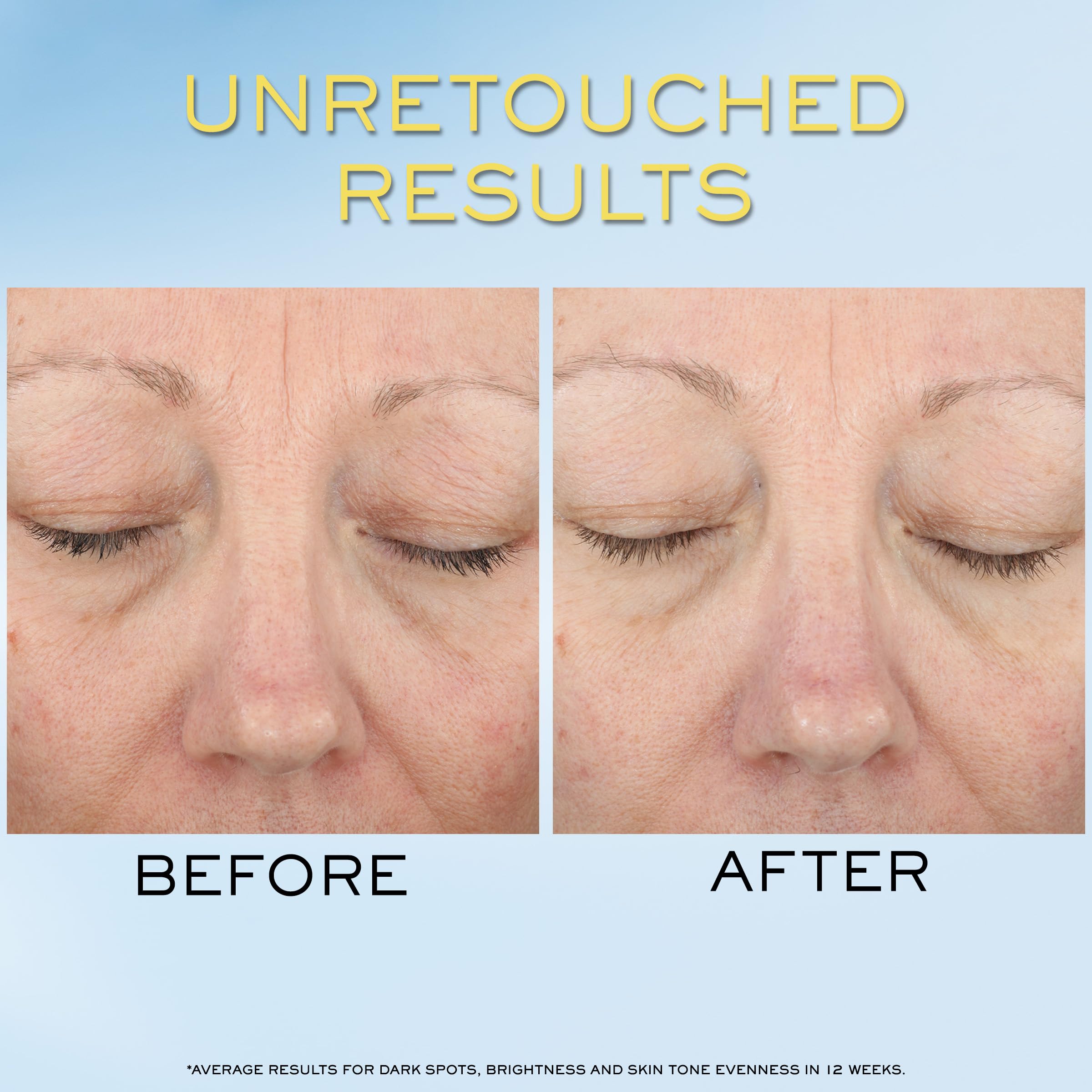Lancôme Niacinamide Vitamin Cg Hyaluronic Acid ingredient graphics.