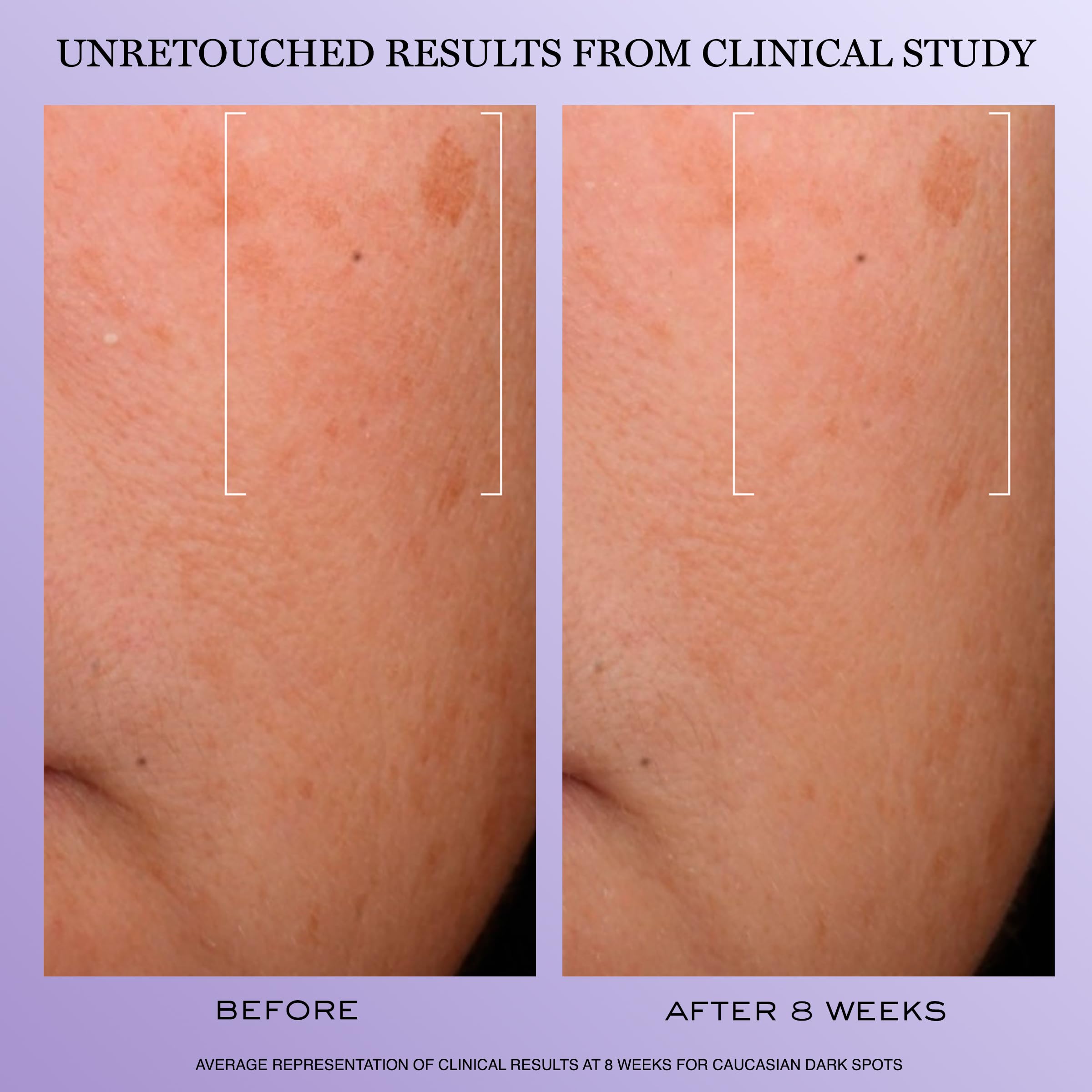 Lancôme Rénergie H.C.F. serum on skin close-up shows quick absorption.