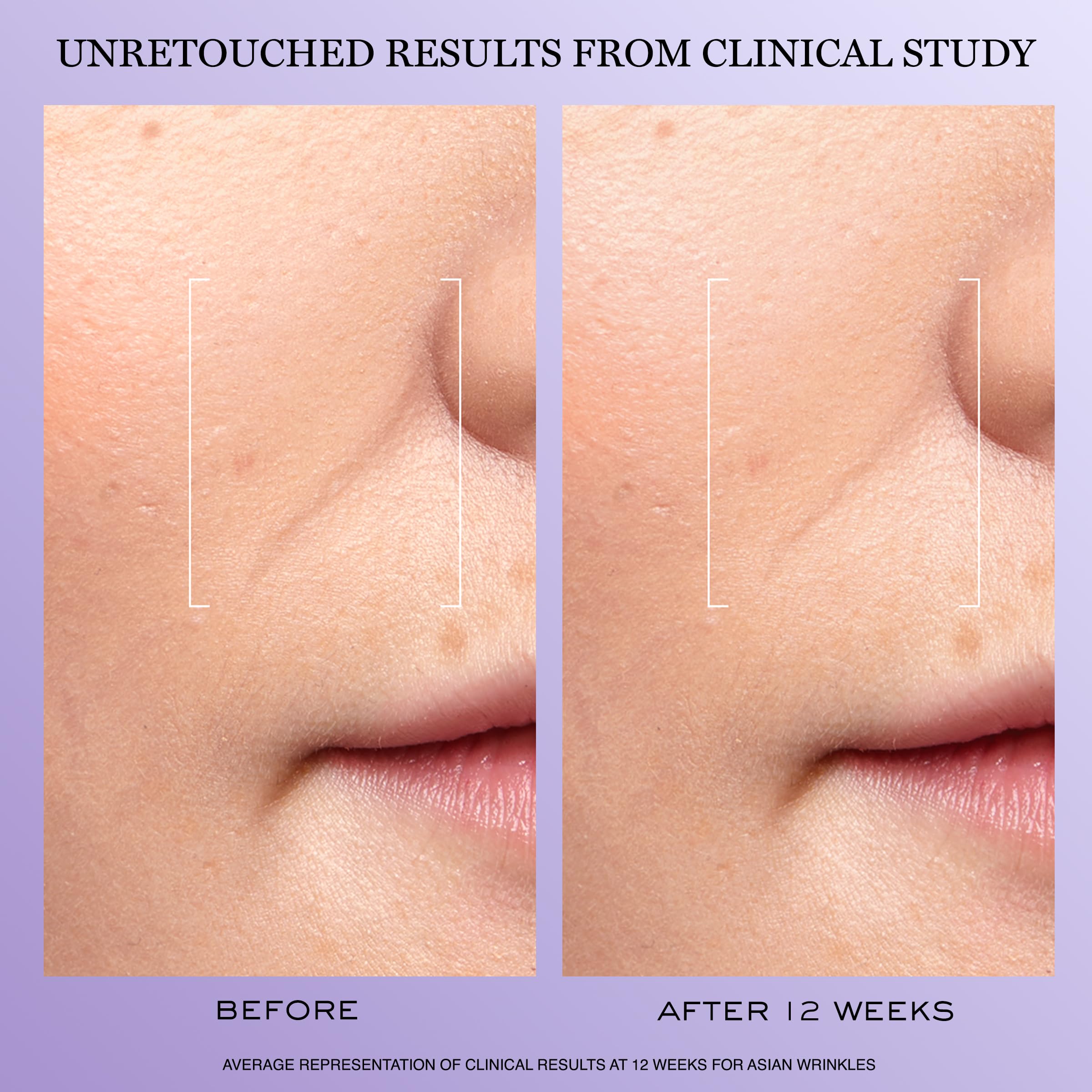Lancôme Rénergie H.C.F. serum texture appears lightweight for fast absorption.