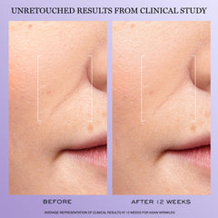 Lancôme Rénergie H.C.F. serum with hyaluronic acid for plump hydration.