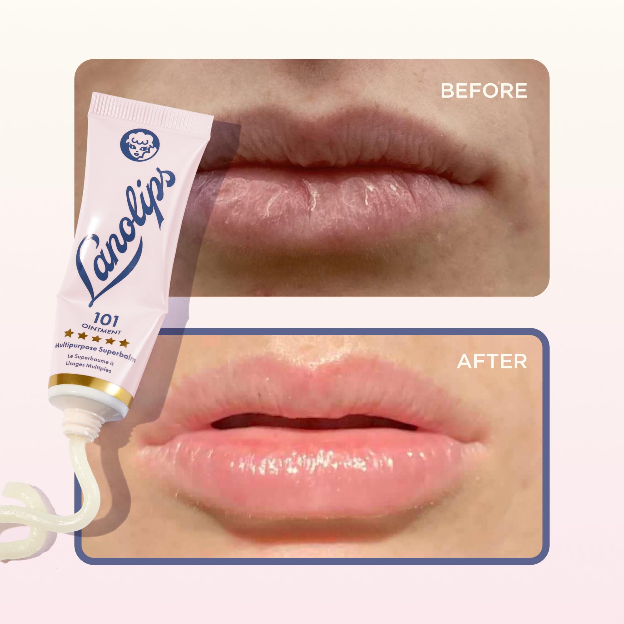 Lanolips 101 Ointment used for nipple-area care during nursing.