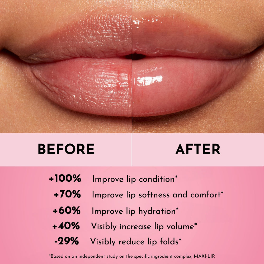 LAWLESS Forget the Filler Lip Mask Sweet Dreams texture close-up illustrating rich hydrating balm.