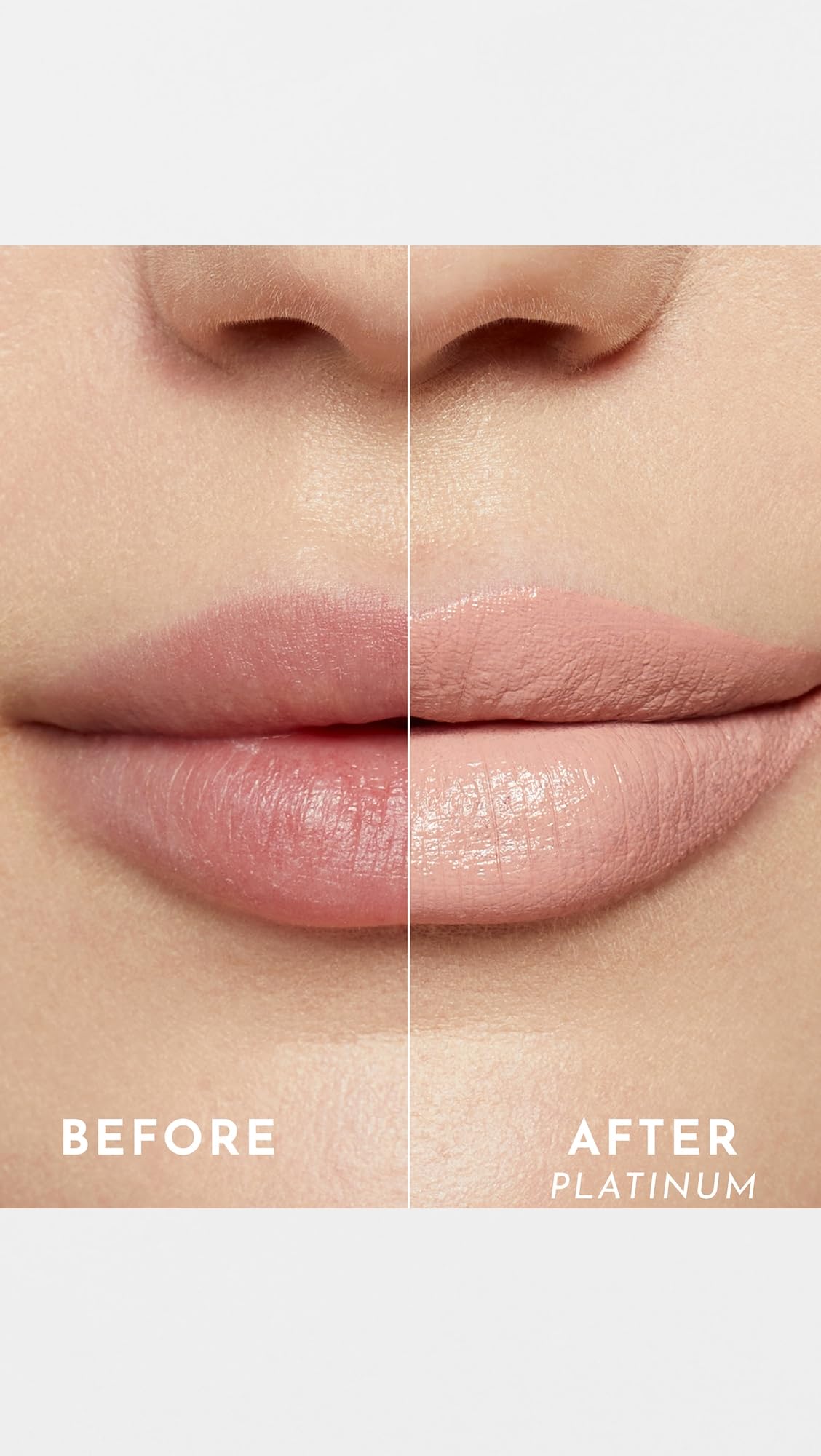 Lawless Forget the Filler lip-plumping effect visual suggesting volume with consistent wear.