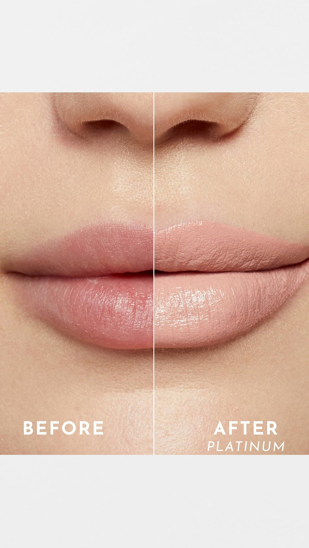 Lawless Forget the Filler lip-plumping effect visual suggesting volume with consistent wear.
