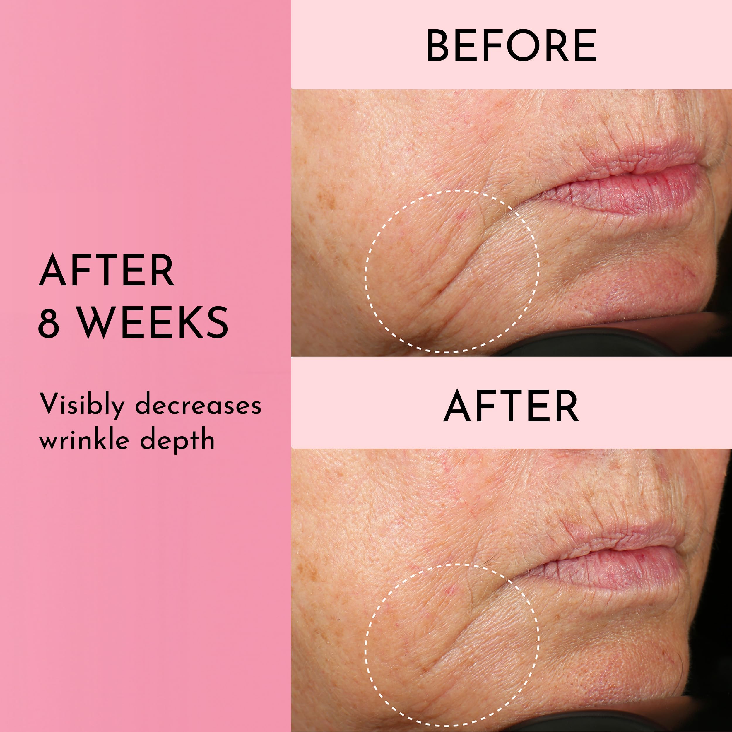 Lawless Mini Forget the Filler ingredients matrix features MAXI-YOUTH and peptides.