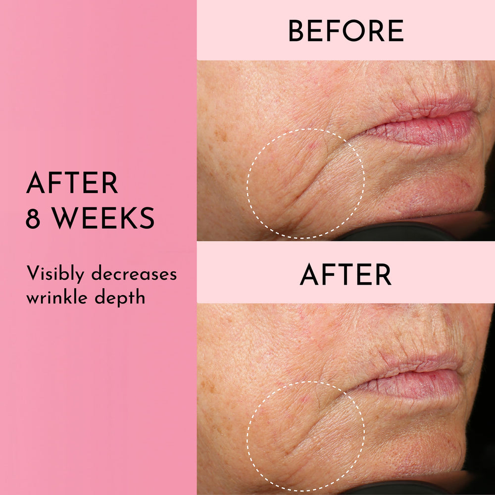 Lawless Mini Forget the Filler ingredients matrix features MAXI-YOUTH and peptides.