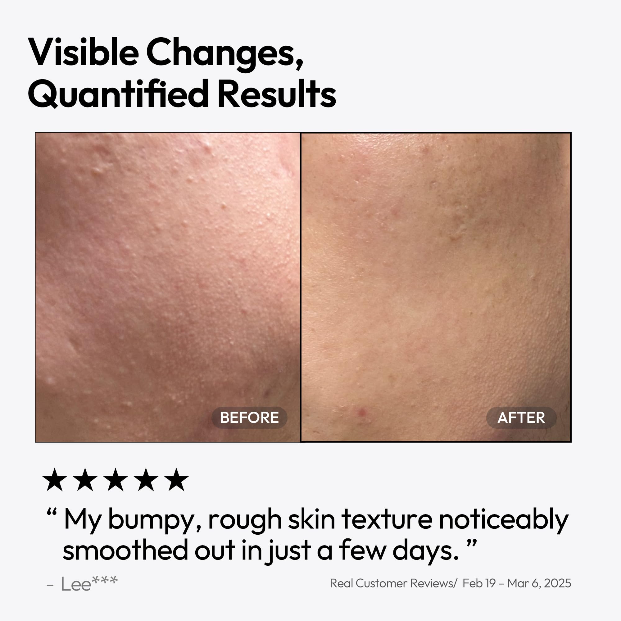 Application on fingertips shows smooth glide and non-greasy finish from LAYERLAB serum.