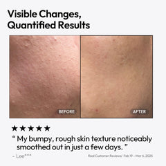 Application on fingertips shows smooth glide and non-greasy finish from LAYERLAB serum.
