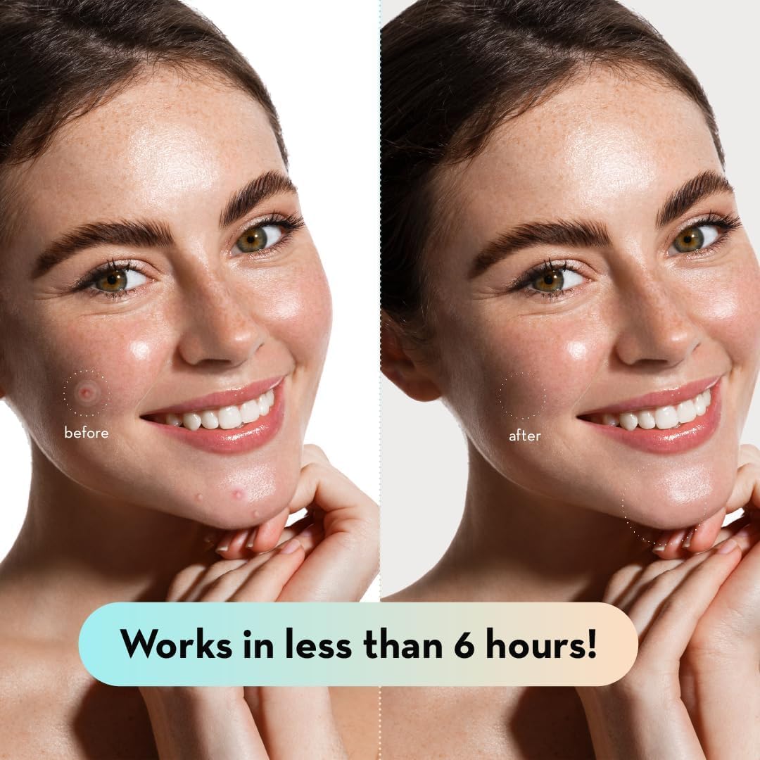 LE GUSHE tea tree oil patch image highlighting soothing acne care