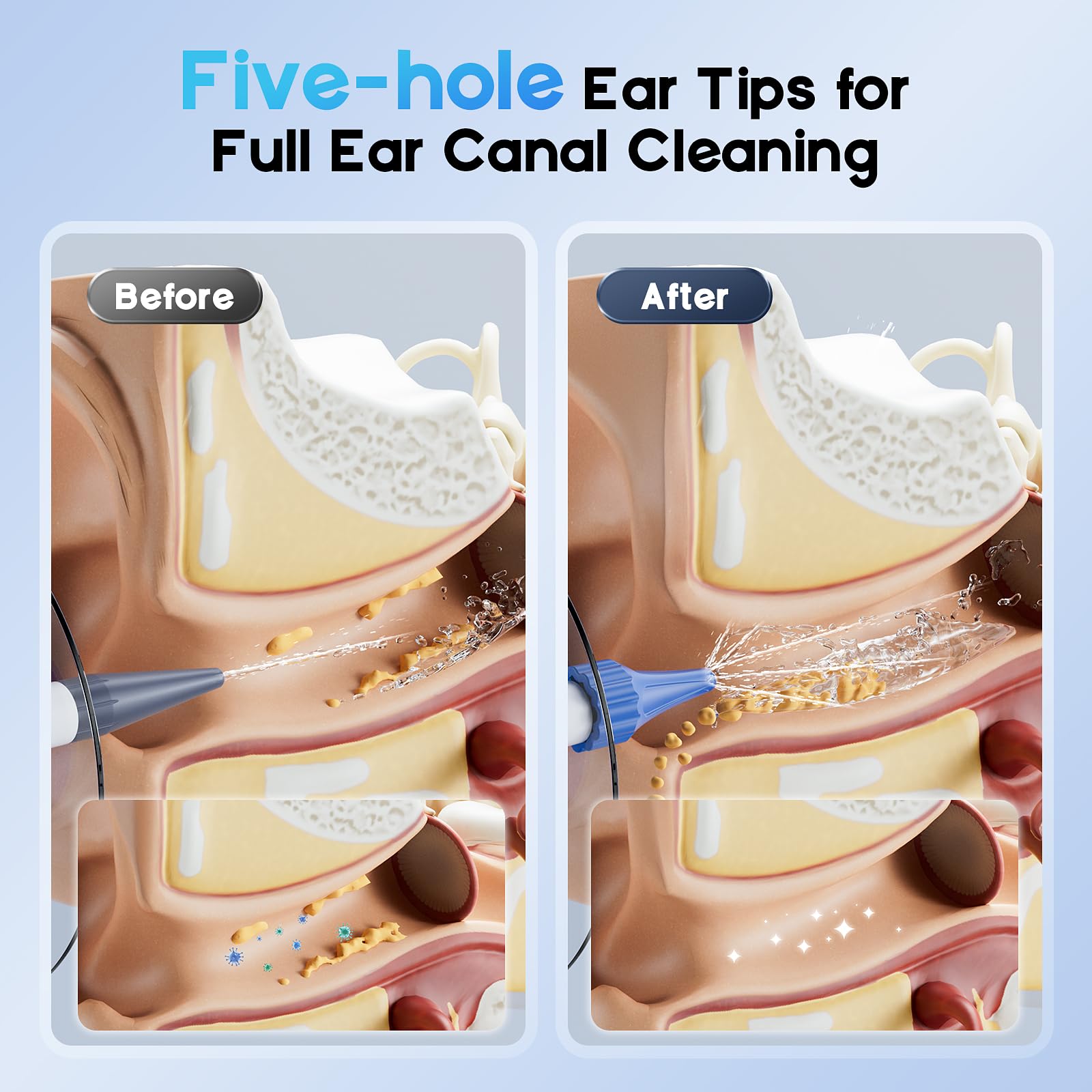 Lebbtl single-hole tip focused stream illustrating targeted stronger cleaning performance