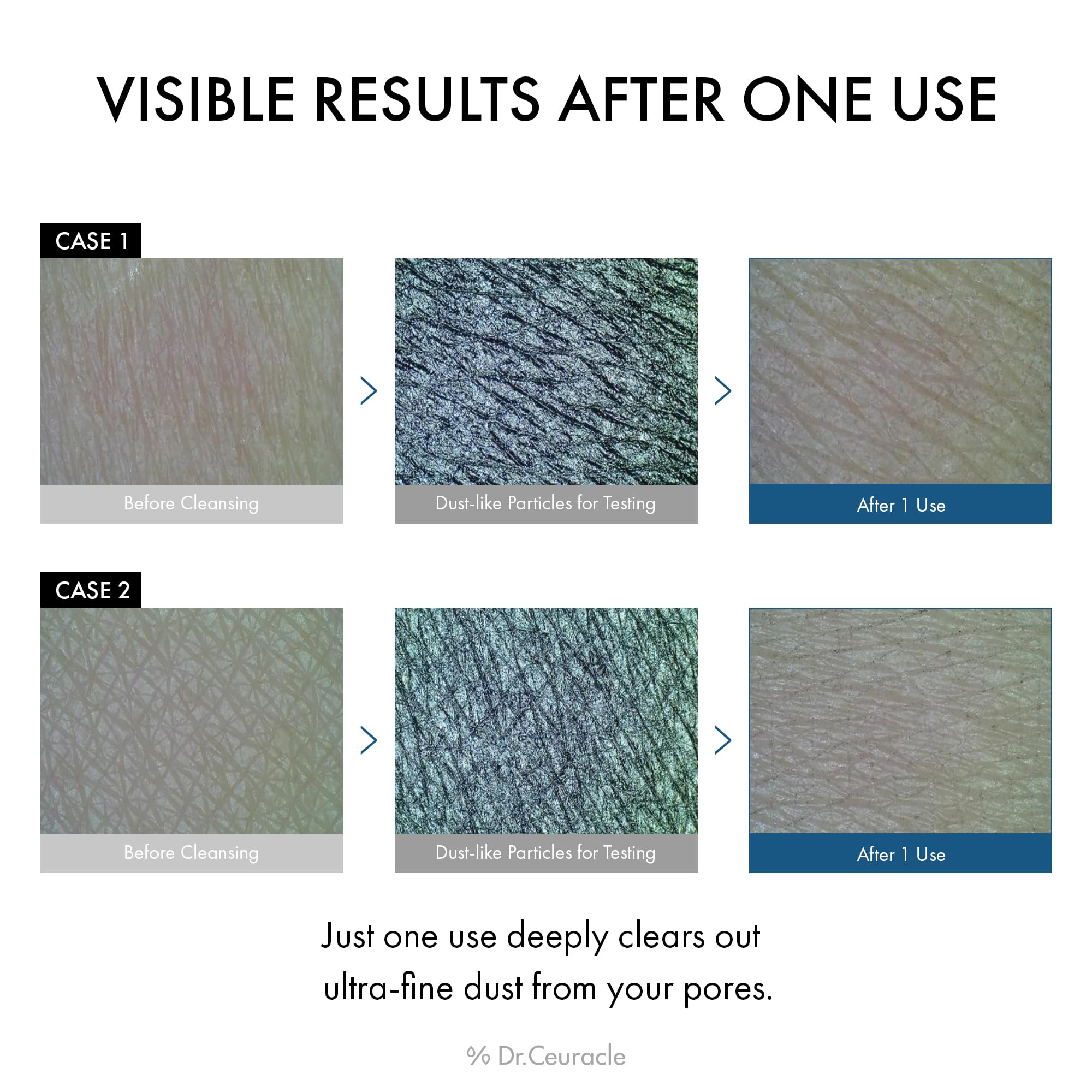 Leegeehaam Dr.Ceuracle Pro Balance enzyme wash deep-pore cleansing foam.