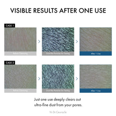 Leegeehaam Dr.Ceuracle Pro Balance enzyme wash deep-pore cleansing foam.