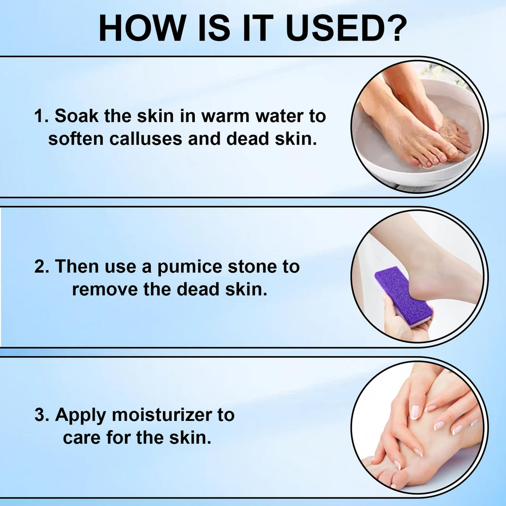 Lenpestia foot pumice stone helps remove calluses effectively