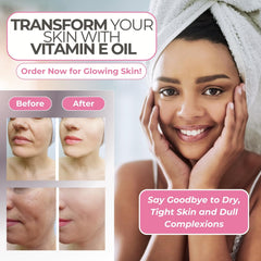 Leven Rose Vitamin E Oil applied on face for nourishing, glowing skin.