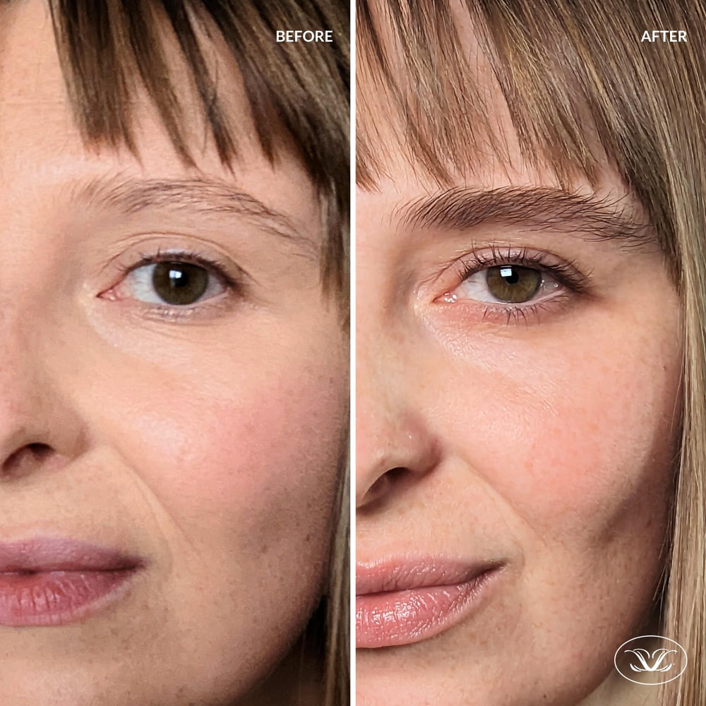 LiBrow before-after comparison showing brow transformation from sparse to fuller.