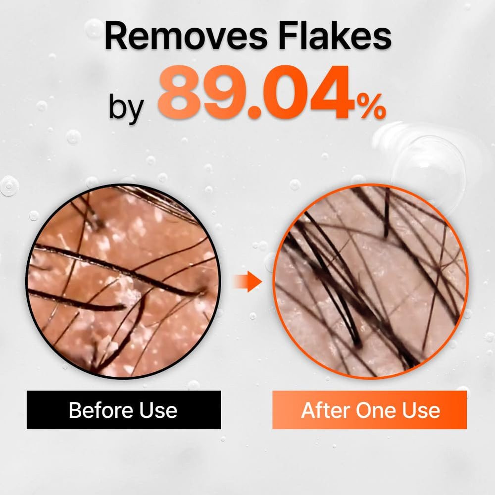 lilyeve GROWTURN bottle on hair conveys lightweight, non-greasy feel