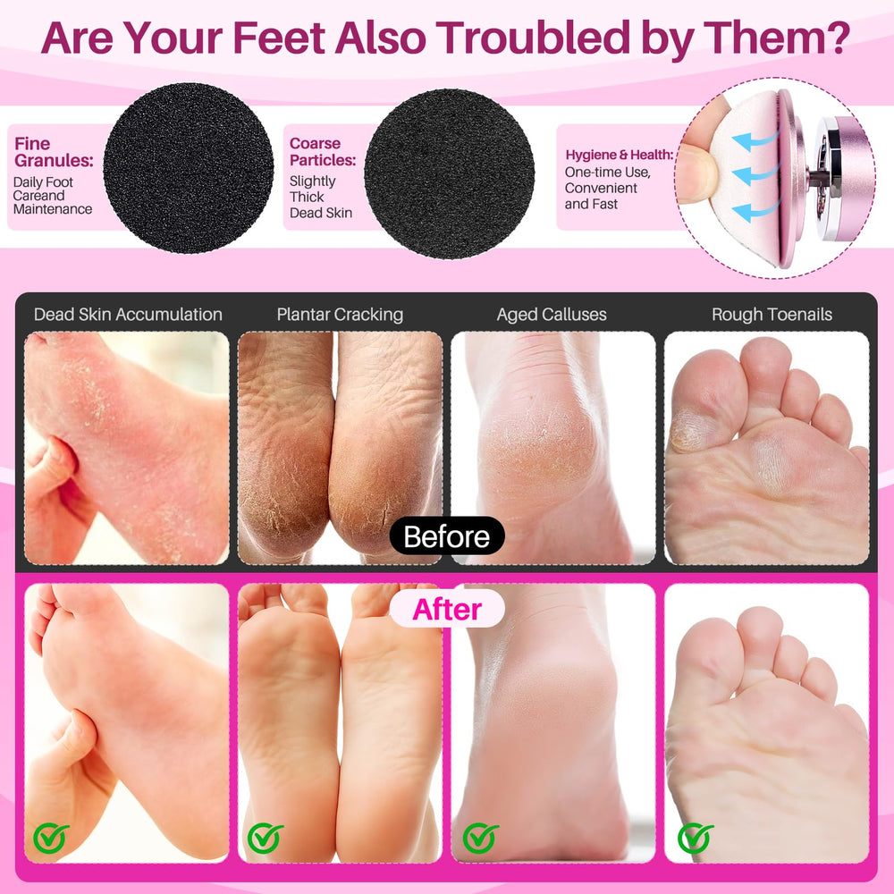 LionVision foot file 360-degree rotation aids reach on heels and toes for full coverage.