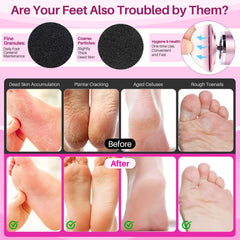 LionVision foot file 360-degree rotation aids reach on heels and toes for full coverage.