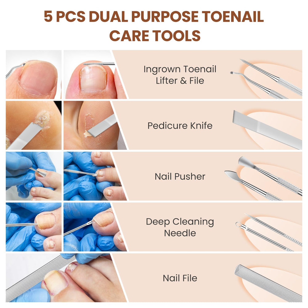 LIONVISON Ingrown Toenail Removal Kit ergonomic handles reduce hand strain during use.