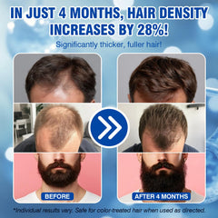Lipend Minoxidil application on scalp showing even coverage.
