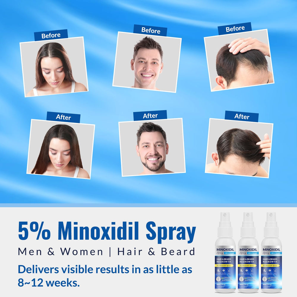 Listarfe 5% Minoxidil for men's hair growth on thinning crown areas.