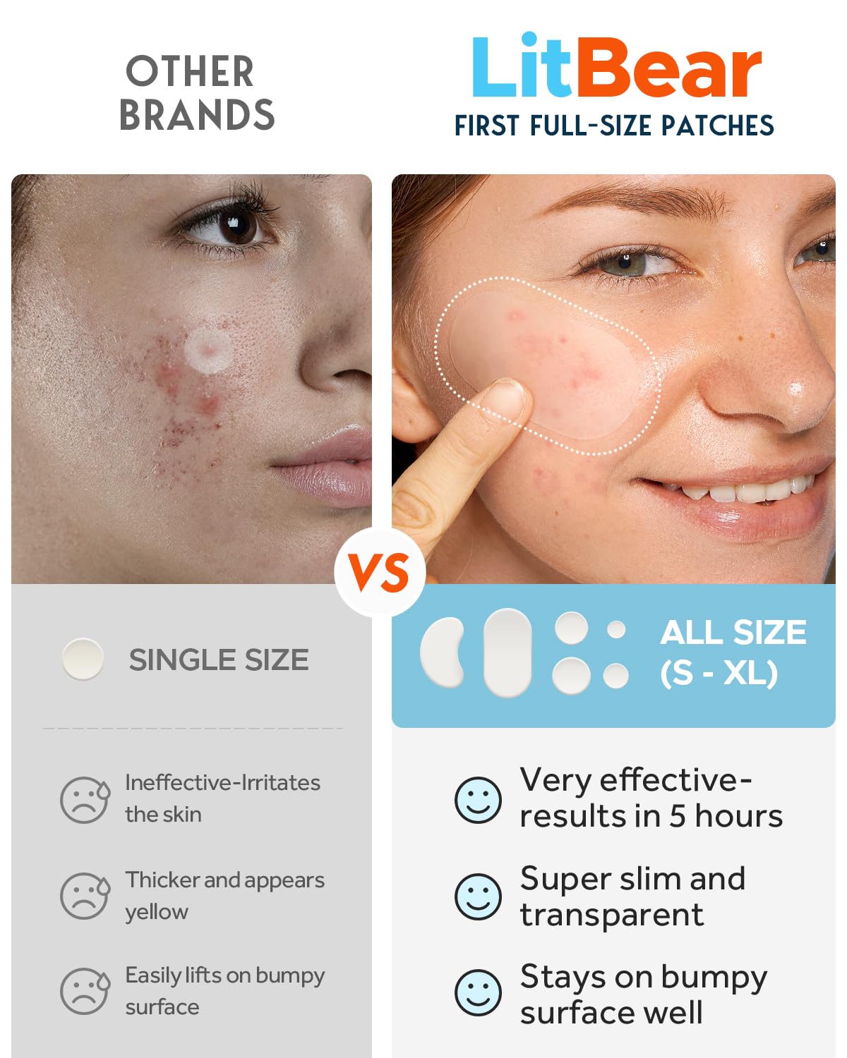 LitBear 14mm acne patch on chin provides large-area coverage.