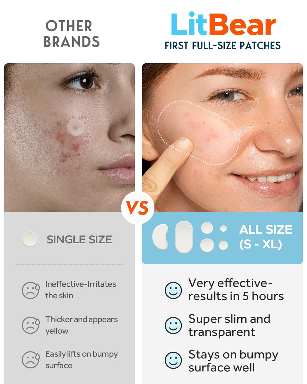 LitBear 14mm acne patch on chin provides large-area coverage.