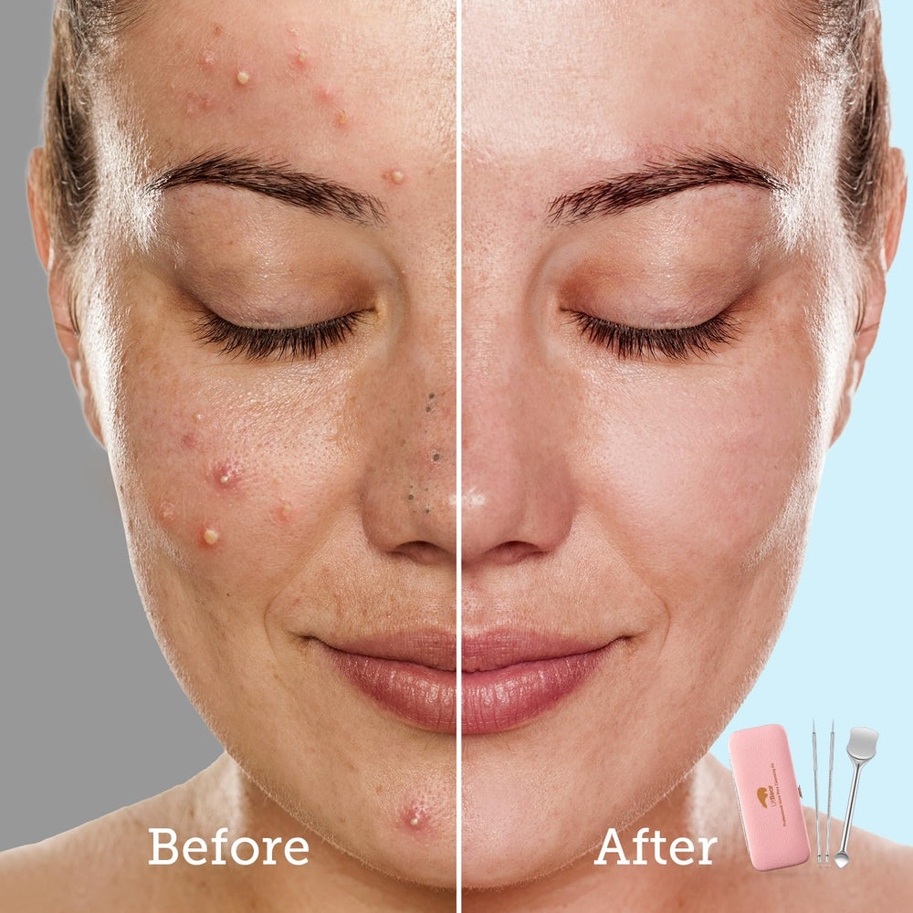 LitBear tool-care reminder—wipe with alcohol before and after uses.