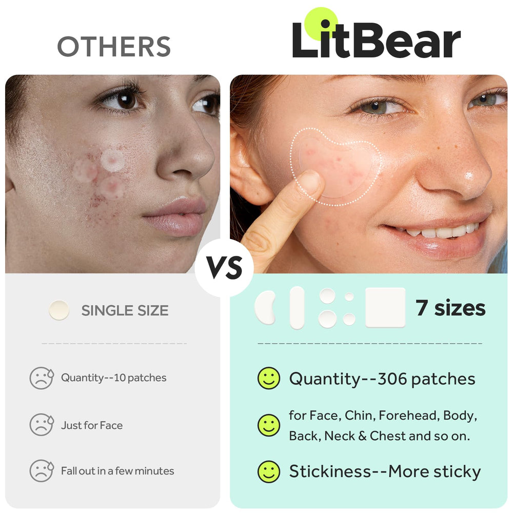 LitBear large pimple patches 60x60mm XL patch for extensive areas and large outbreaks