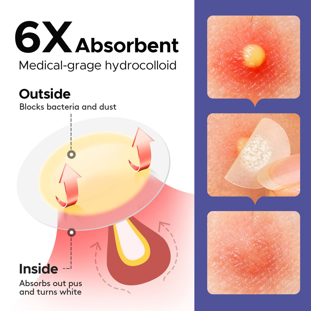 LitBear patch absorption action demonstrating gunk removal from zit