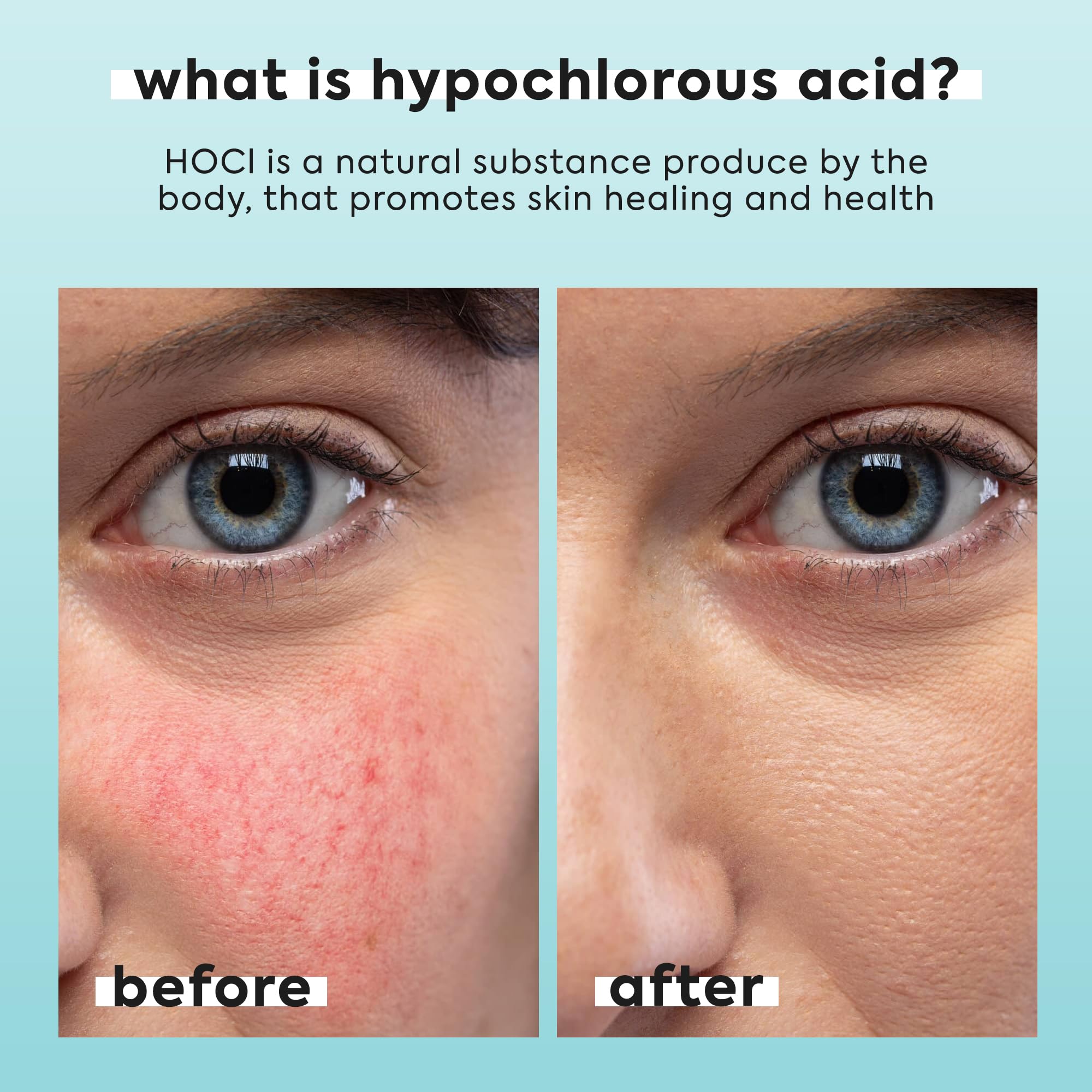LivaClean hypochlorous spray body-use shows versatile refreshing skin care.