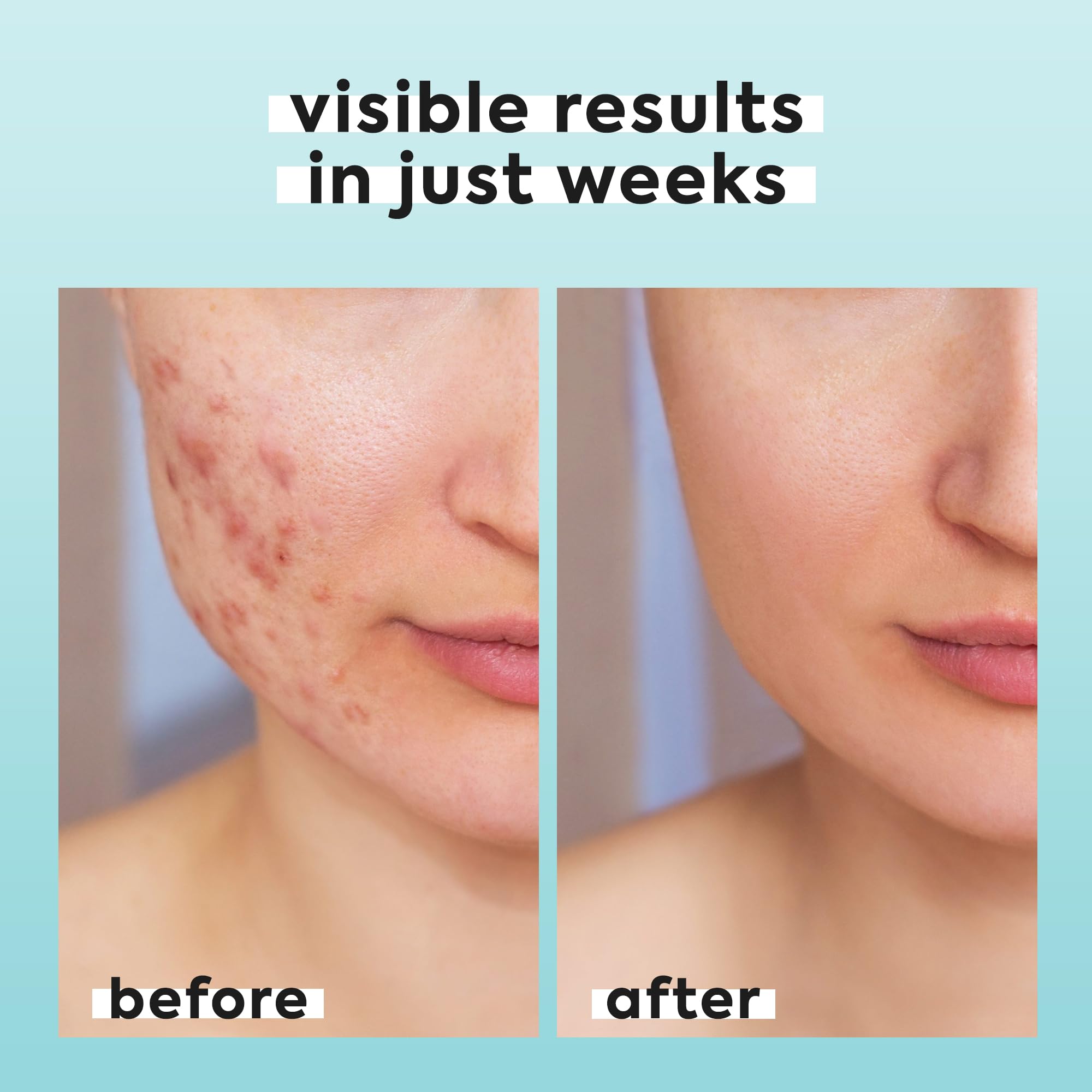 LivaClean travel-size HOCl spray for on-the-go refresh and quick revitalization.