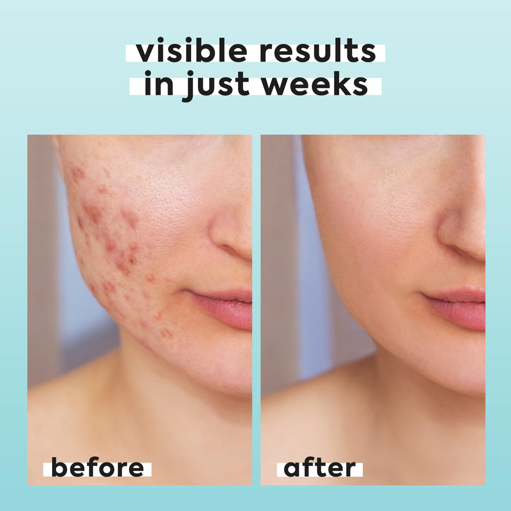 LivaClean travel-size HOCl spray for on-the-go refresh and quick revitalization.