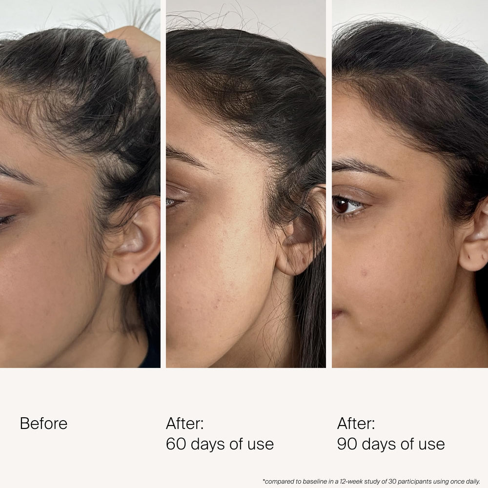 Living Proof Scalp Density Serum applied to scalp for daily use