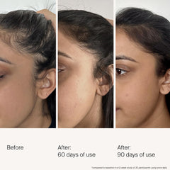 Living Proof Scalp Density Serum applied to scalp for daily use