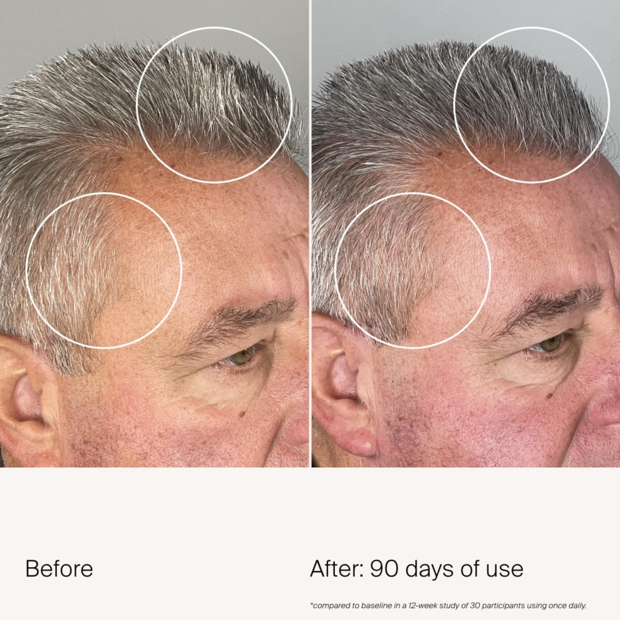 Crown-area application of Living Proof Scalp Density Serum
