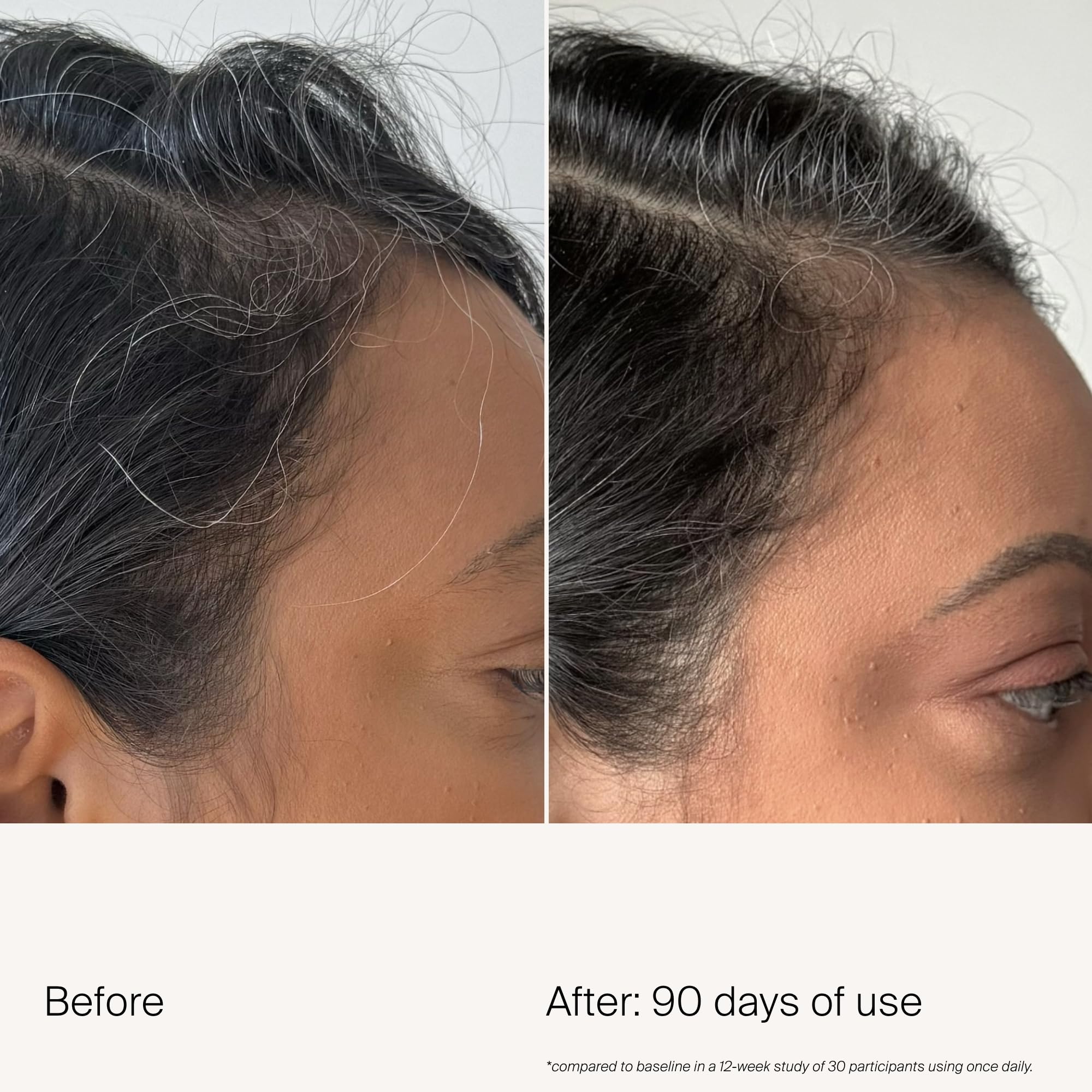 Close-up of Living Proof Scalp Density Serum texture ready to spread