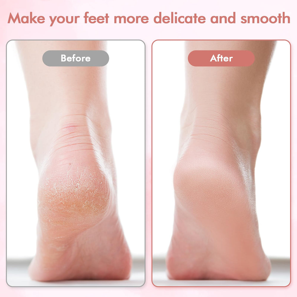 LIYUJSDZ electric foot file fine head close-up for daily smoothing and polishing.