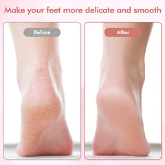 LIYUJSDZ electric foot file fine head close-up for daily smoothing and polishing.