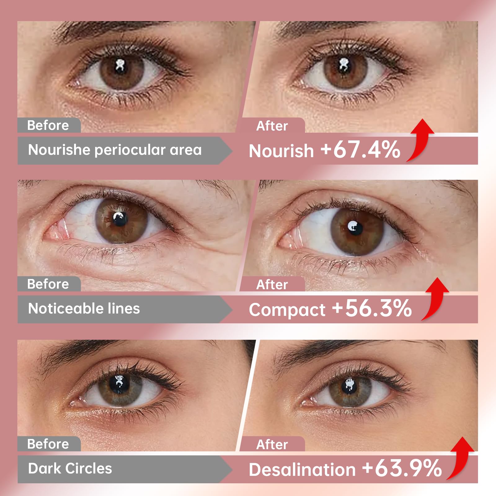 LLVYUO Novoy Rose eye patches made in the USA with hypoallergenic materials